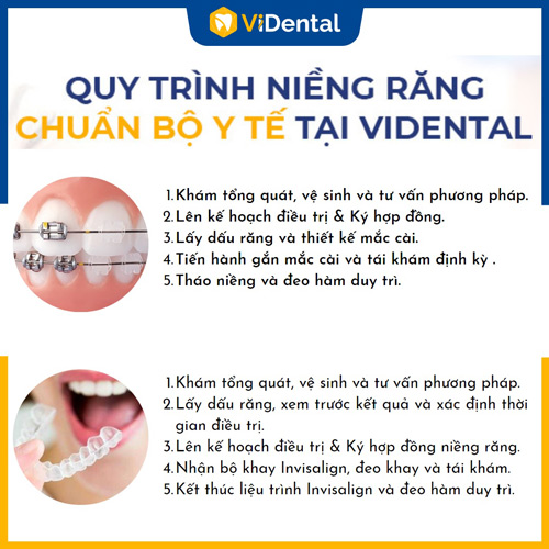 Quy trình niềng răng CHUẨN BỘ Y TẾ tại ViDental Brace - Trung Tâm Niềng Răng Thẩm Mỹ Quốc Tế