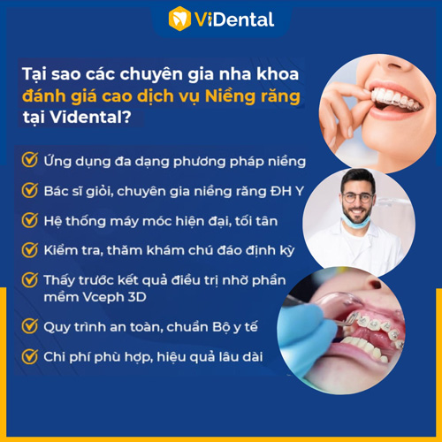 Niềng răng tại ViDental giúp bạn tối ưu thời gian, chi phí