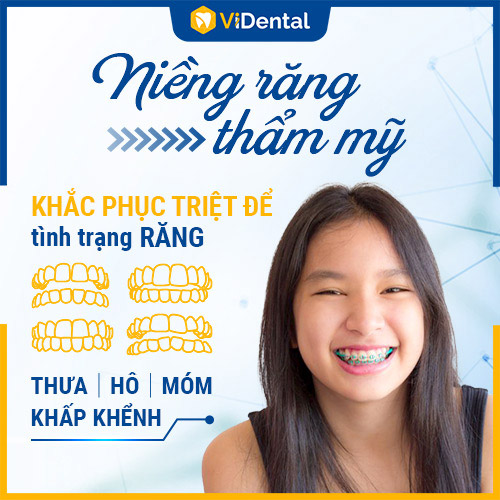 Niềng răng tại ViDental Brace - Giải pháp TỐI ƯU cho mọi tình trạng răng lệch, hô,...