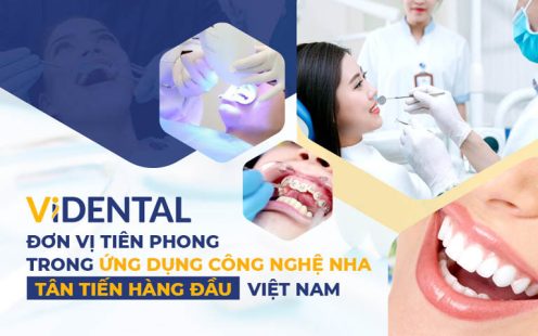 Lựa Chọn Số 1 Về Trồng Răng, Phục Hình Thẩm Mỹ Tại Việt Nam - Nha Khoa ViDental 