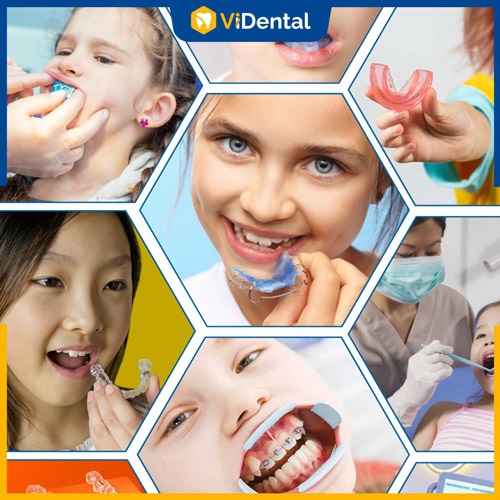 Niềng răng trẻ em tại ViDental Brace  - Lựa chọn SỐ 1 cho mọi phụ huynh