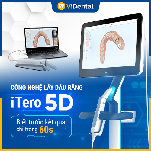 Máy quét dấu răng iTero 5D hiện đại số 1