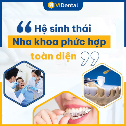 Vidental là hệ thống nha khoa niềng răng uy tín hàng đầu hiện nay
