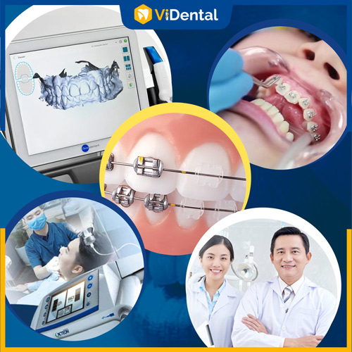 Nên lựa chọn nha khoa có giấy phép và chuyên môn sâu khi niềng răng 