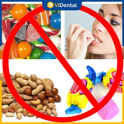 Khi niềng răng, cần hạn chế ăn đồ cứng để giảm đau đớn