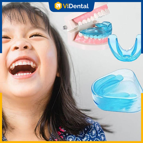 Niềng răng Silicon cho trẻ em là phương pháp chỉnh nha phổ biến