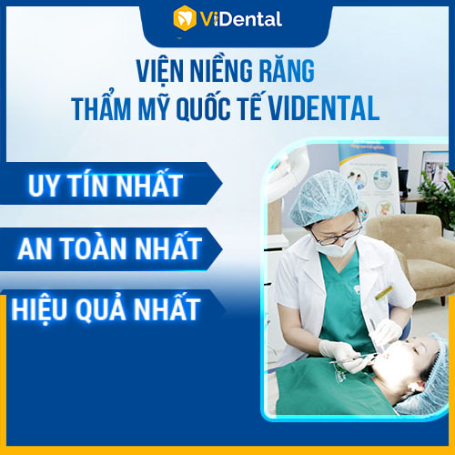 Vidental cung cấp dịch vụ niềng răng uy tín, an toàn, hiệu quả