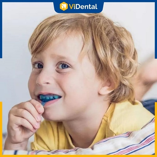 Niềng răng ở độ tuổi vàng giúp nâng cao hiệu quả chỉnh nha