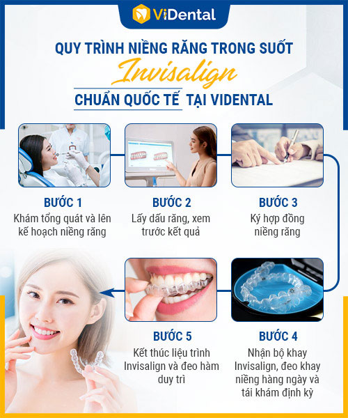 Quy trình các bước niềng răng Invisalign CHUẨN QUỐC TẾ tại ViDental