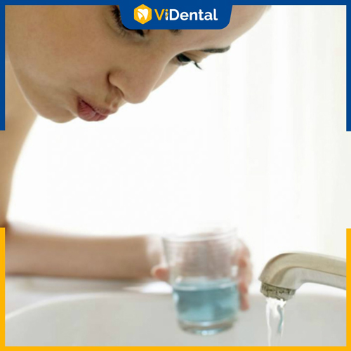 Cần vệ sinh răng miệng đúng cách để đảm bảo tiến độ niềng răng