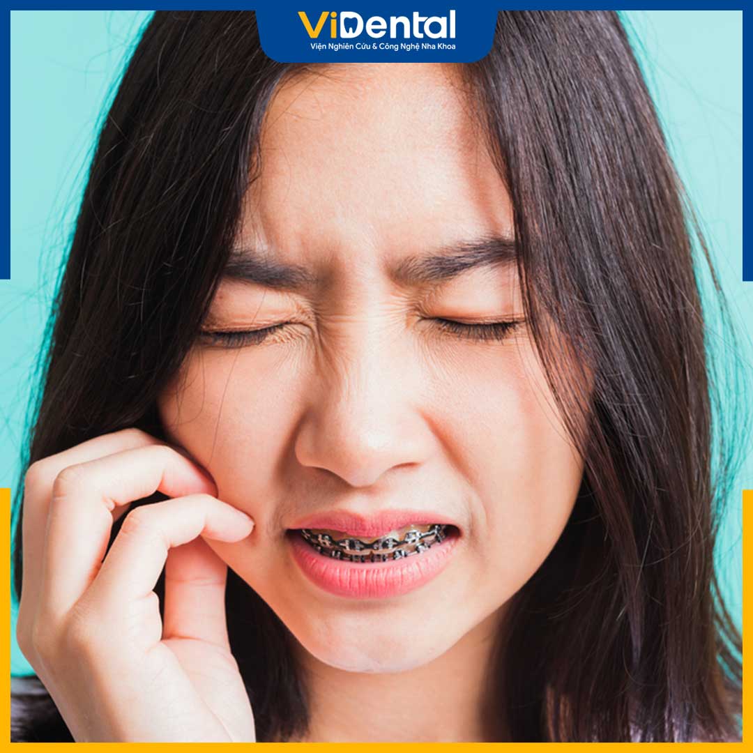 Mức độ đau đớn và cảm giác của mỗi người khi niềng răng sẽ khác nhau