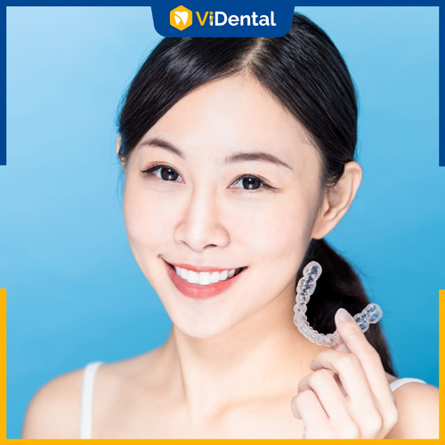 Thời gian niềng răng trong suốt có thể kéo dài từ 9 - 32 tháng