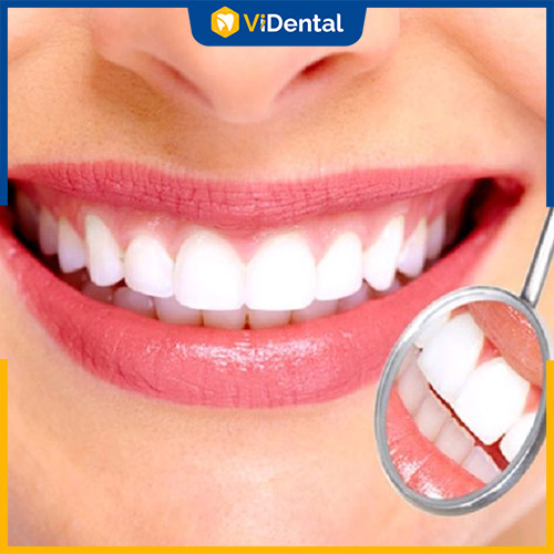 Bọc răng sứ có nhiều ưu, nhược điểm riêng