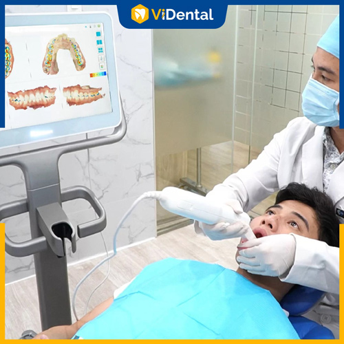 Vidental ứng dụng công nghệ hiện đại vào quy trình niềng răng