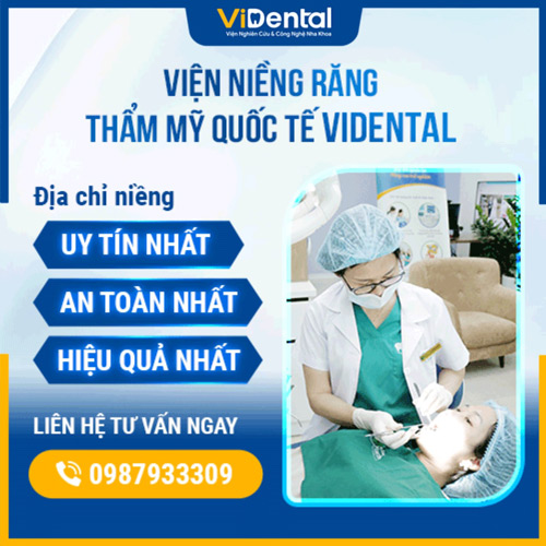 ViDental - Lựa chọn hàng đầu khi có nhu cầu niềng răng thẩm mỹ