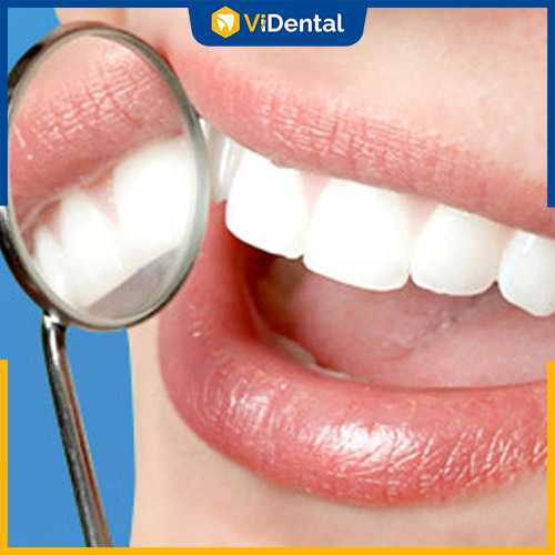 Nên bọc răng sứ hay niềng răng là vấn đề nhiều khách hàng quan tâm