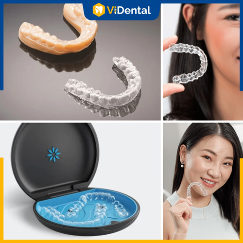 Niềng răng 3D Clear và Invisalign có nhiều điểm tương đồng