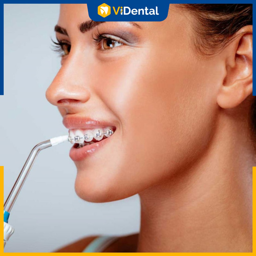 Chú ý chăm sóc răng miệng đúng cách theo hướng dẫn của bác sĩ nha khoa