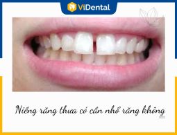 [Giải Đáp Chi Tiết] Niềng Răng Thưa Có Cần Nhổ Răng Không?