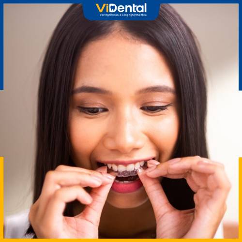 Nhiều yếu tố ảnh hưởng việc niềng răng trong suốt có gây đau không