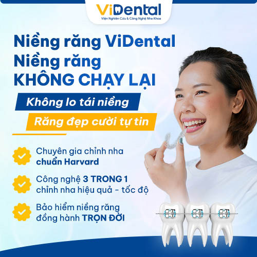 Không lo răng dịch chuyển hậu tháo niềng tại ViDental