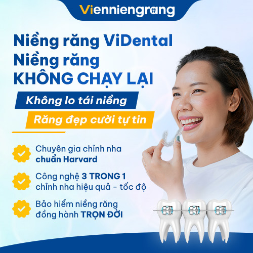 Niềng răng ViDental - Phương pháp niềng răng đẹp trọn đời