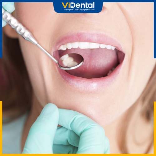 Tình trạng răng miệng ảnh hưởng đến chi phí làm răng cho người lớn