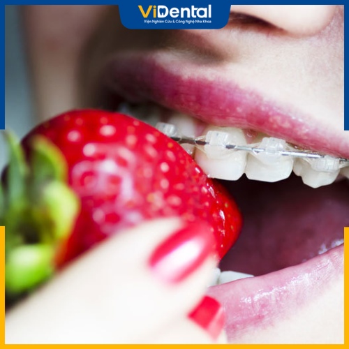 Ăn các loại thực phẩm tốt cho sức khỏe khi niềng răng giữ răng khểnh 