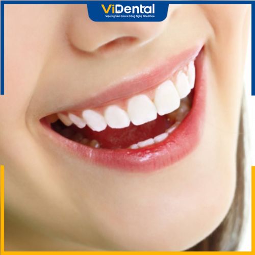 Kết quả điều trị răng hô nặng phụ thuộc vào nhiều yếu tố