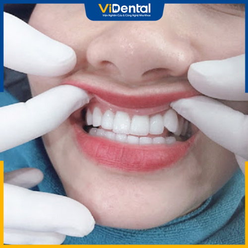 Khám định kỳ nha khoa để đảm bảo sức khỏe răng miệng của bạn