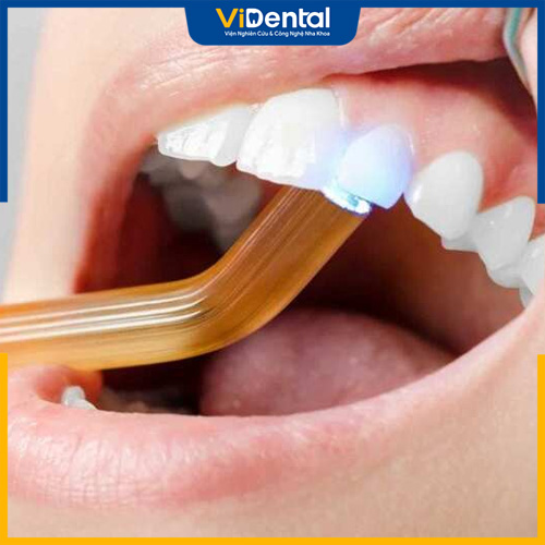 Trám răng có thể phục hồi khả năng ăn nhai và thẩm mỹ