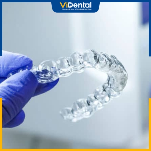 Dụng cụ bảo hộ răng có vai trò như một tấm rào chắn giữa khí cụ niềng và các mô mềm trong khoang miệng