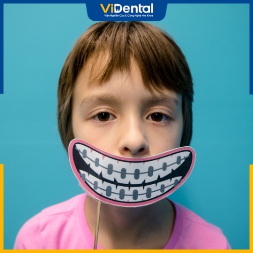 Trẻ niềng răng sớm giúp mang lại nhiều thay đổi tích cực trên khuôn mặt