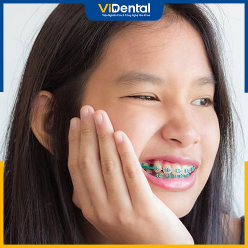 Dấu hiệu khi mới niềng răng là răng ê buốt và đau nhẹ