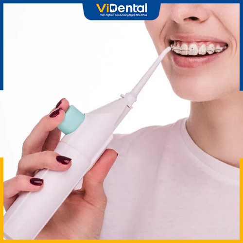 Chú ý cách vệ sinh răng miệng khi mới niềng răng