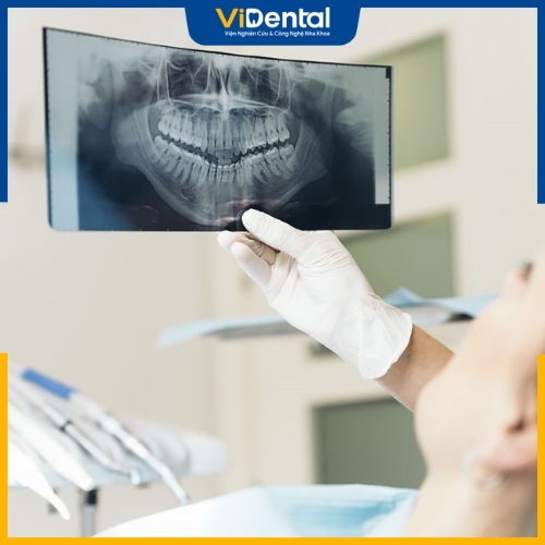 Nếu trong quá trình niềng răng, bạn gặp các vấn đề như tụt lợi, bật chân răng… hãy đến ngay cơ sở nha khoa để được xử lý kịp thời