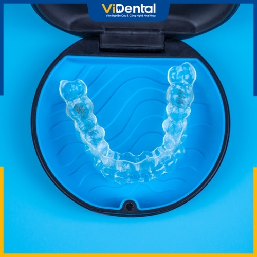 Niềng răng trong suốt loại bỏ nỗi lo vô tình nuốt dây cung niềng răng