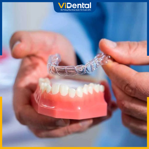 Mỗi nha khoa khác nhau có mức giá niềng răng không giống nhau