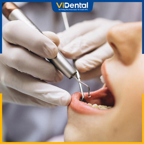 Quá trình nhổ răng bằng thiết bị hiện đại sẽ không gây đau đớn