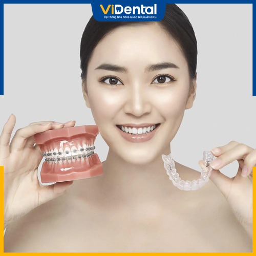 Phương pháp niềng răng Invisalign đã có những cải tiến nhằm mang đến hiệu quả vượt trội