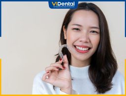 Review niềng răng invisalign